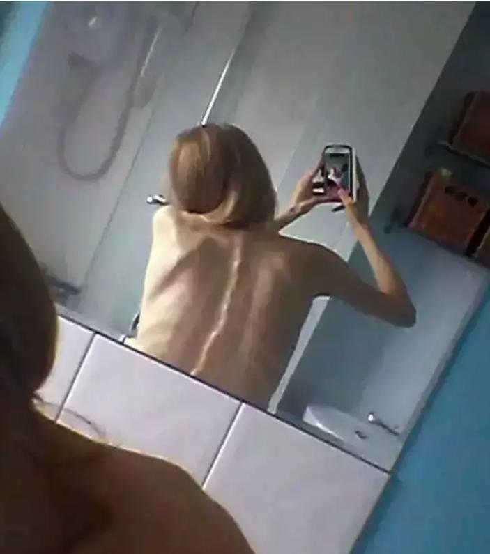 50cm“仙女管”插入少女胃里,这种自虐工具竟在淘宝卖疯了