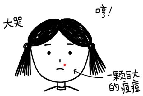 怎么去闭口粉刺痘痘脂肪粒,护肤毛孔粗大闭口怎么补救