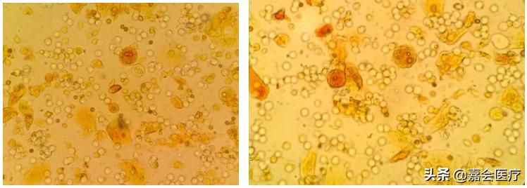 尿液突然变红、变绿？注意这些常见药会改变尿液颜色