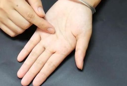 挑刺不用针的小窍门,怎么用大长针挑刺