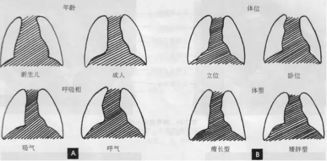 x线影像解剖大全,胸部x线怎么看懂图解