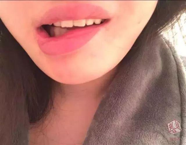 整容改脸型多少钱,女子花3万5整形结果