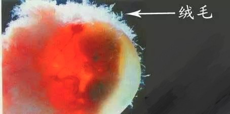 宝宝排畸哪个检查重要,宝妈小排畸主要检查什么