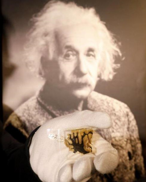 爱因斯坦被偷大脑全过程,爱因斯坦竟然被人偷走大脑的秘密