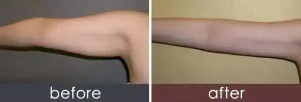 娱乐圈好看的腿,娱乐圈长筒袜