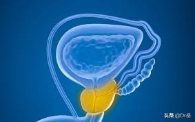 前列腺炎的治疗方式有几种,前列腺炎要治疗吗不治疗会怎样