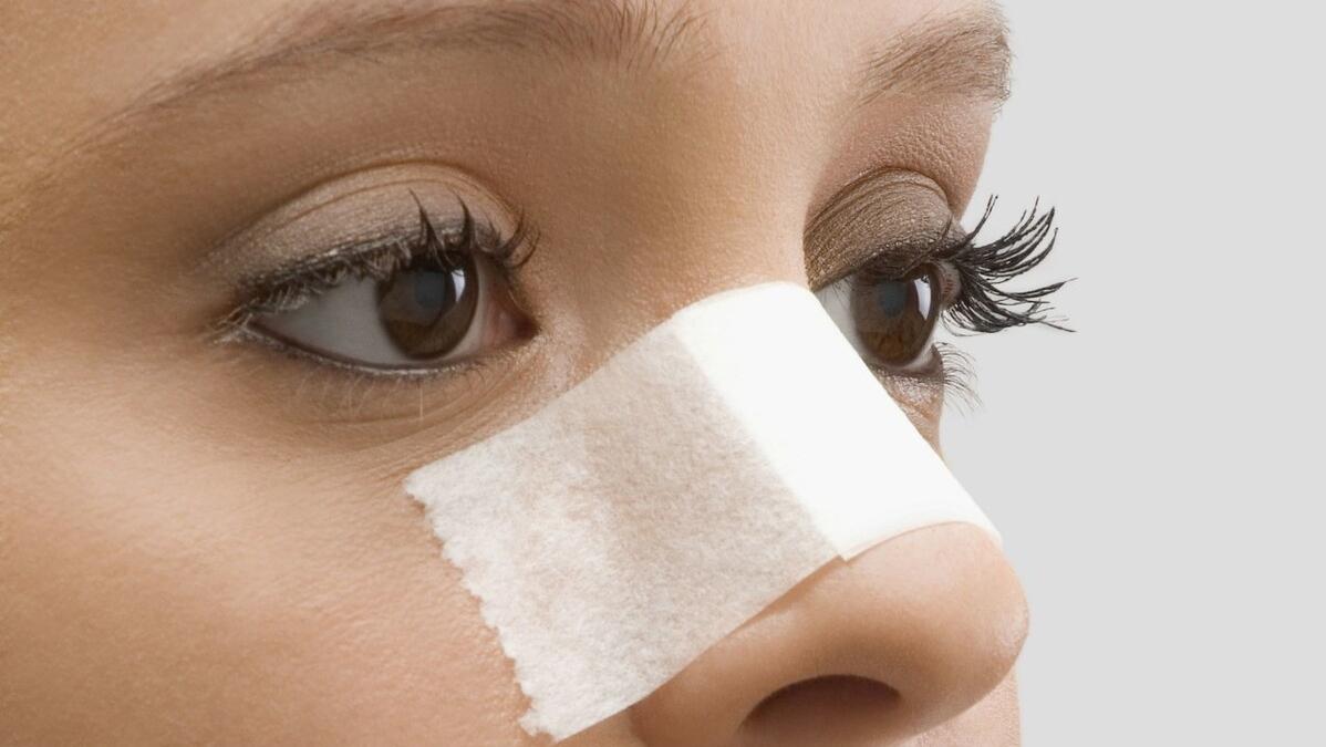 整容不一定能改变命运,整容整形真实经历