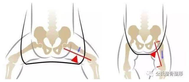 想要宝宝腿型好看怎么办,想要小孩长得好看吃什么