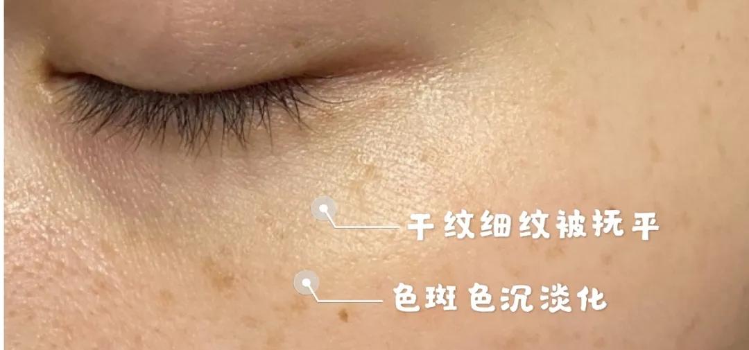 小玛急救水怎么用,小玛急救水好用吗