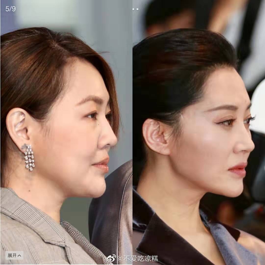 逆天侧颜女,逆天绝世容颜