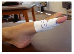 大脚趾尖端疼痛,拇趾跖趾关节痛是怎么回事