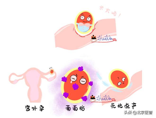 孕期服药需谨慎，孕妈妈应这样使用“保胎药”