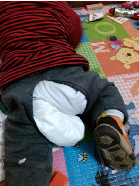 给宝宝选纸尿裤,如何判断纸尿裤尺码不适合