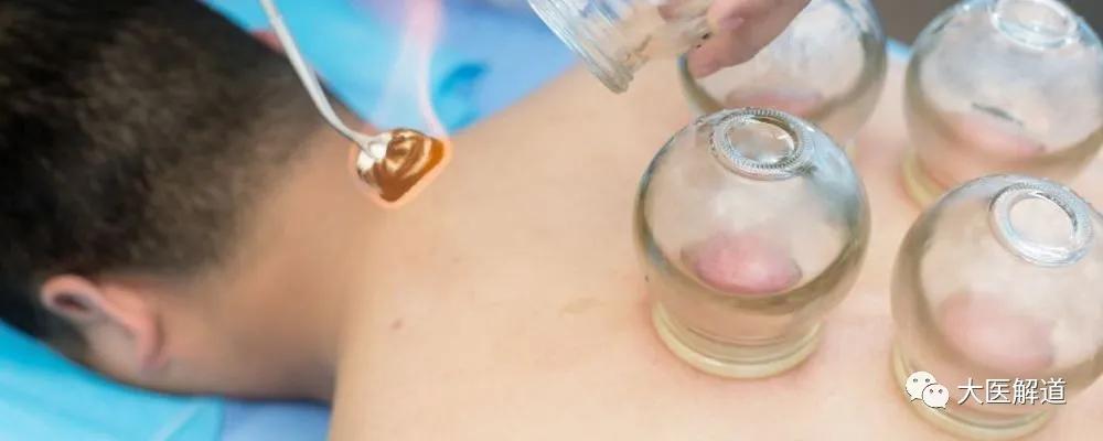 拔火罐利用了什么知识,拔火罐的技巧和手法视频