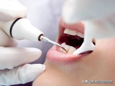 pmtc洗牙和普通洗牙有什么区别吗,39.9洗牙和150洗牙有什么区别