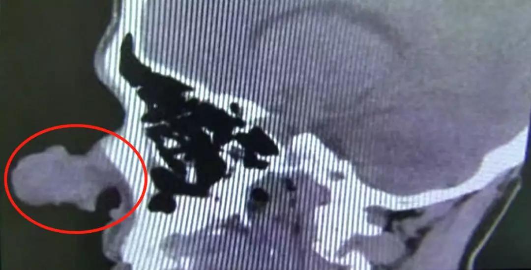 男子鼻子被取笑像匹诺曹,男子因长相被嘲笑