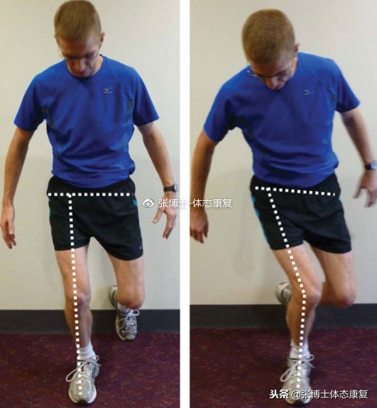 单脚下蹲时膝盖内扣的解决办法,膝外翻和膝内扣区别方法