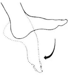 脚底疼痛警惕四种病,脚底疼痛怎么处理