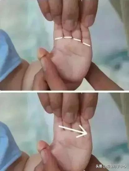 小儿推拿便秘咳嗽,小儿推拿积食通便