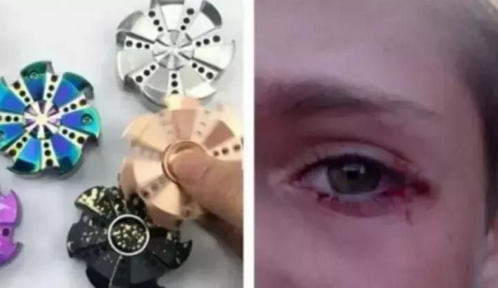 眼睛险失明,毒素超标,听力受损…这些网红夺命儿童玩具别再买