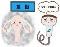 早孕阴式彩超能查出来吗,孕期查看孕囊是做阴超吗