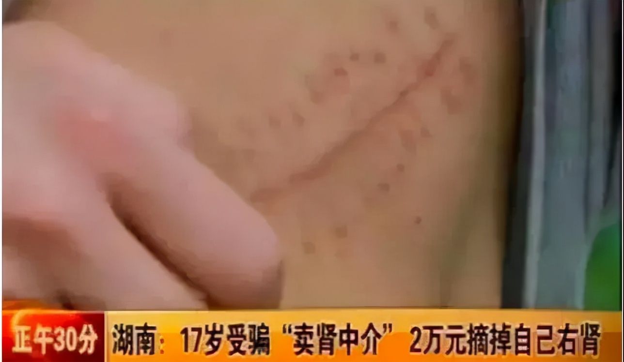 赌命交易是骗人的吗,一定要警惕骗人的套路