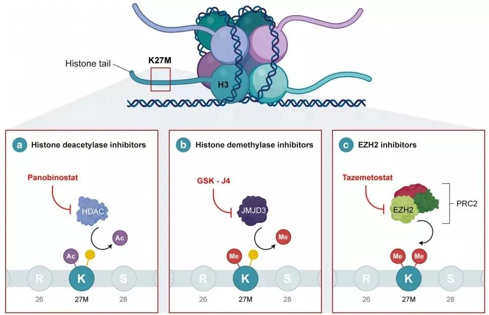 一级脑干胶质瘤,脑干胶质瘤指南