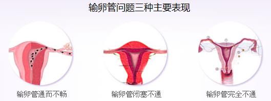 妇科炎症的危害以及妇科检查项目