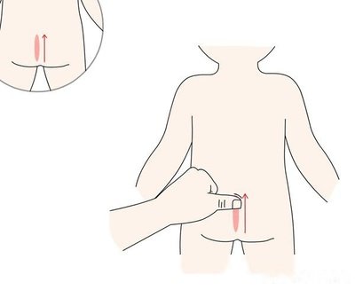 小儿腹泻推拿常用手法,小儿呕吐腹泻脾胃失调小儿推拿