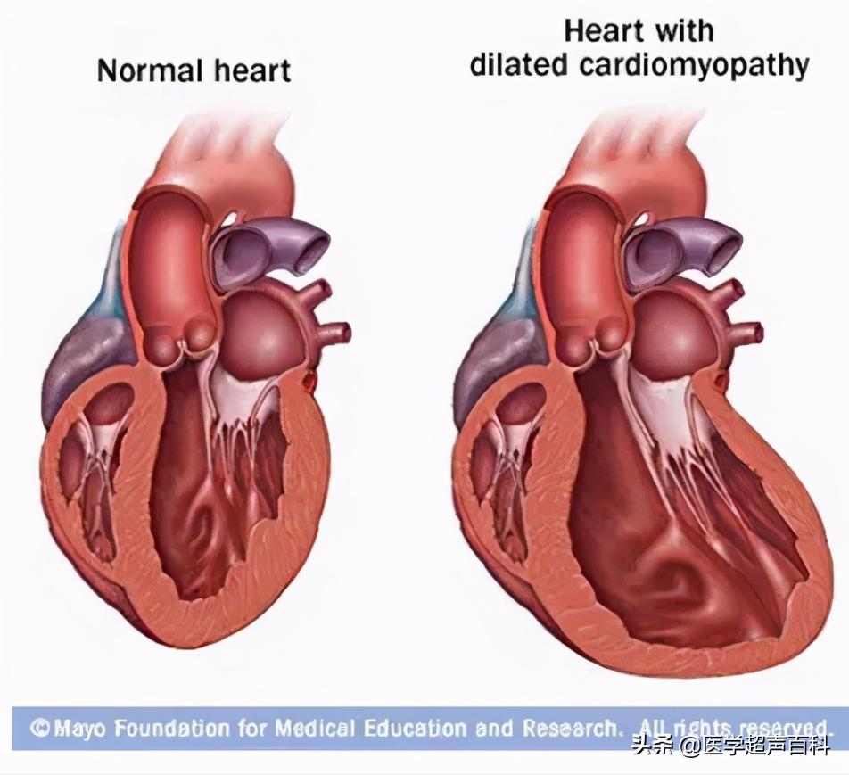 怎么样成为一名b超医生,b超医生的独白