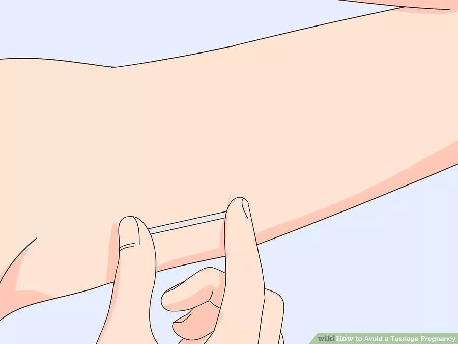 有没有外用避孕措施,有什么办法可以安全避孕吗