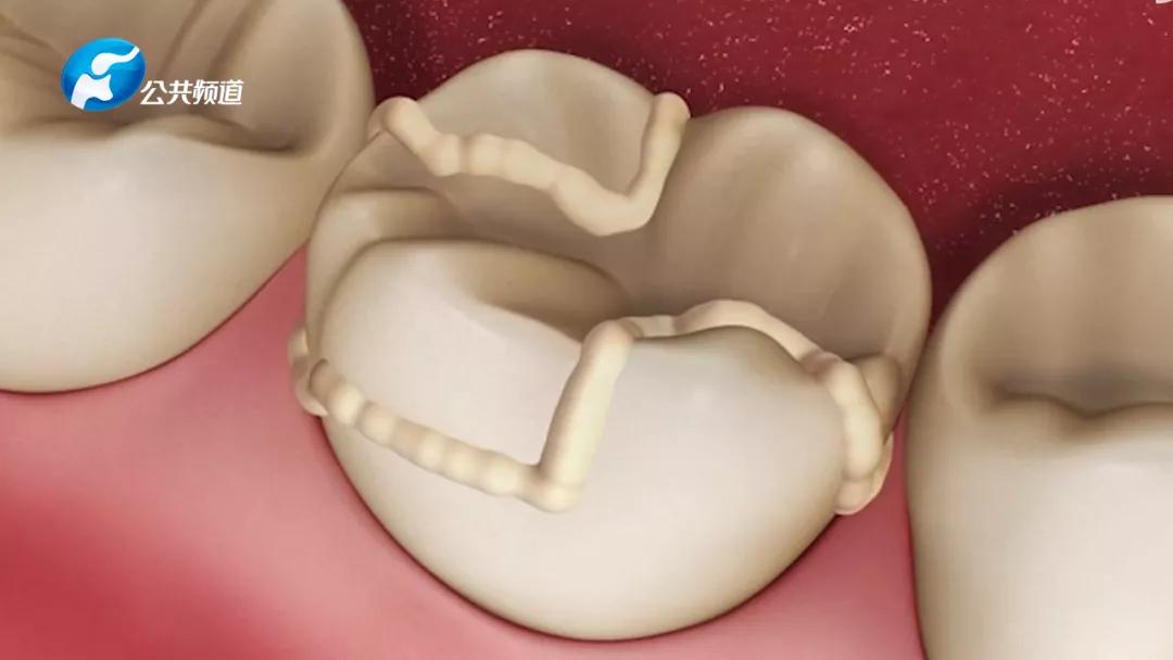 关注口腔健康从爱牙开始,关注口腔