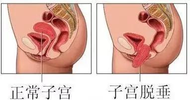 小产过后需要做什么检查,42天产后宝宝检查要免费还是自费