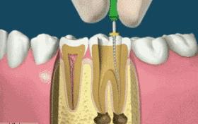 年龄大了牙齿松动掉落怎么办,小孩换牙牙齿松动掉落怎么扯掉