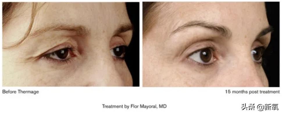 很多人夸赵丽颖,赵丽颖都被谁夸过