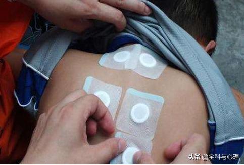 水泡破了可以用敷贴吗,敷贴过敏起水泡怎么处理