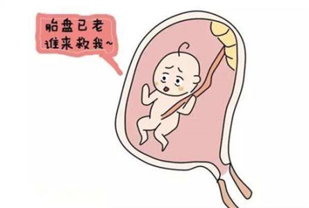 孕35周胎盘开始钙化,胎盘钙化2级什么意思