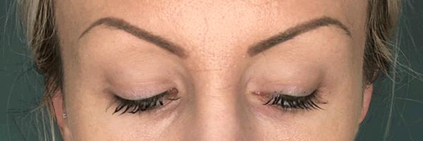 长期开车眼睛疲劳有什么好办法,长期开车有助于恢复视力