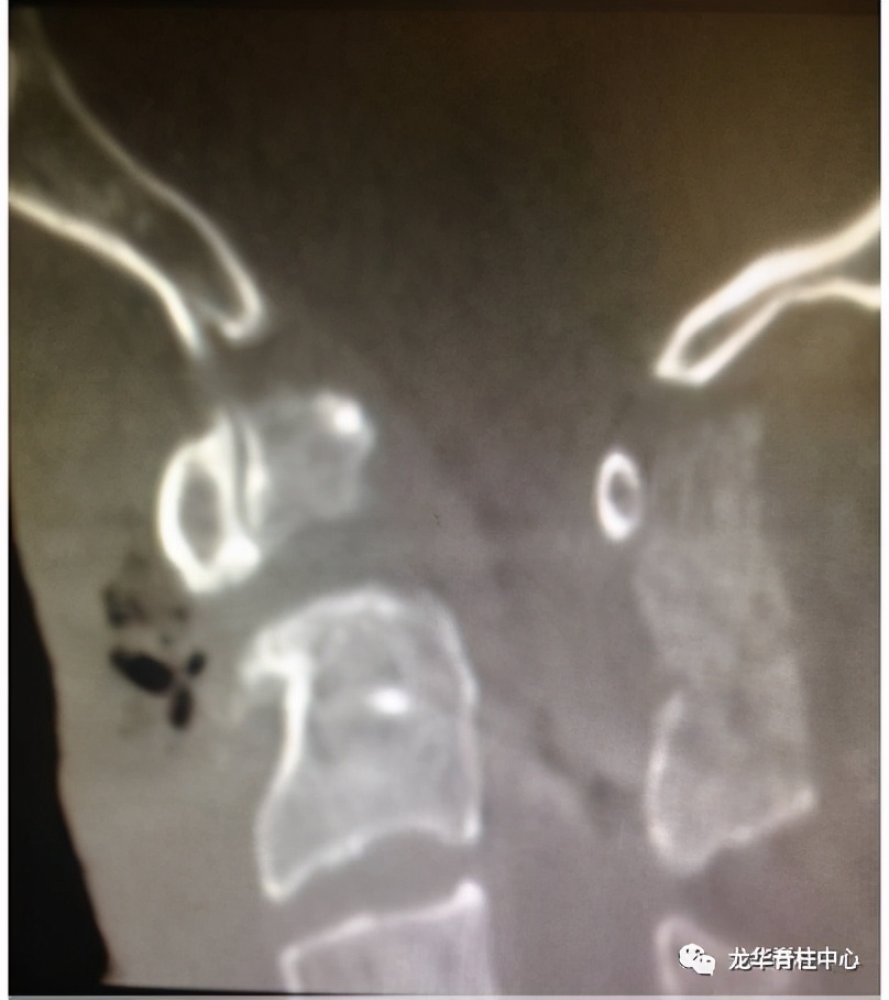 深圳市龙华区人民医院脊柱外科简介