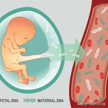 nt值高唐筛是做无创还是羊穿,孕期检查唐筛和无创dna到底选哪个