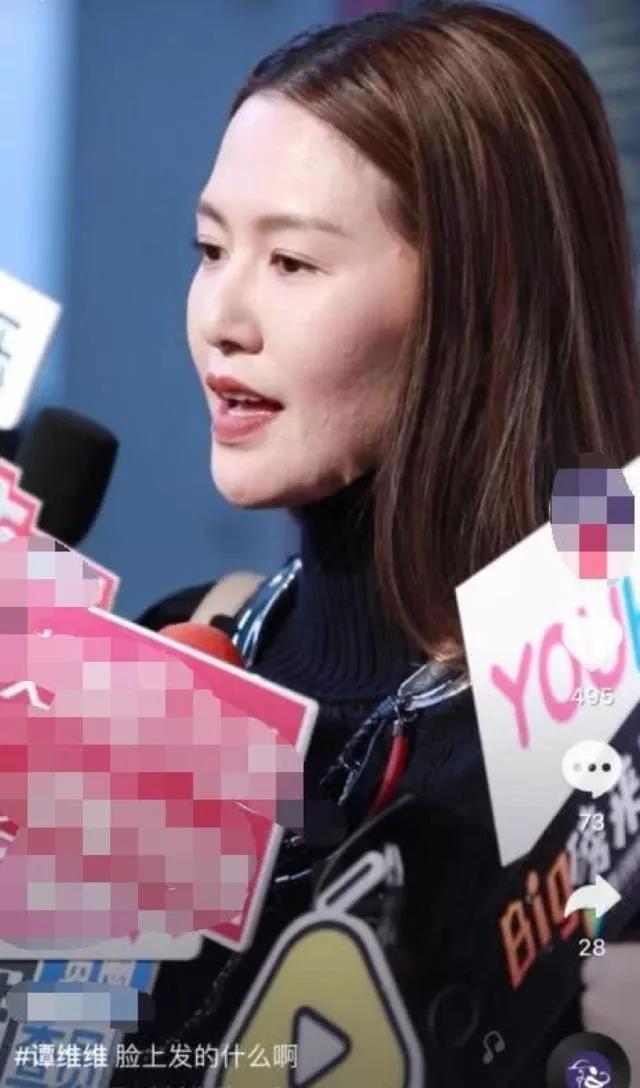 皮肤黄暗沉健身可以改善吗,由内而外调理暗沉痘印