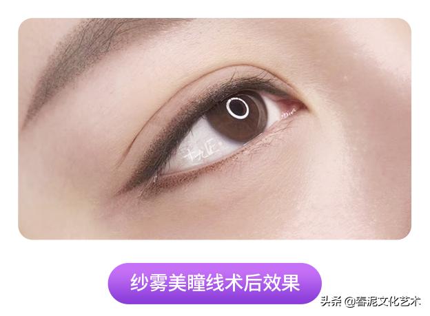 眼睛戴美瞳有血丝红肿怎么办,眼睛戴了美瞳红肿一碰就痛