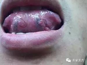 舌头是人体自带的体检表，一旦出现这个信号，马上去医院