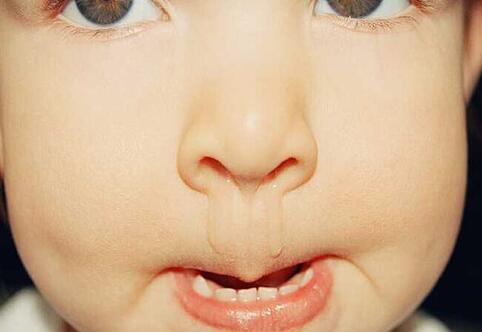 宝宝风寒流鼻涕需要吃药吗,宝宝风寒流鼻涕吃什么药