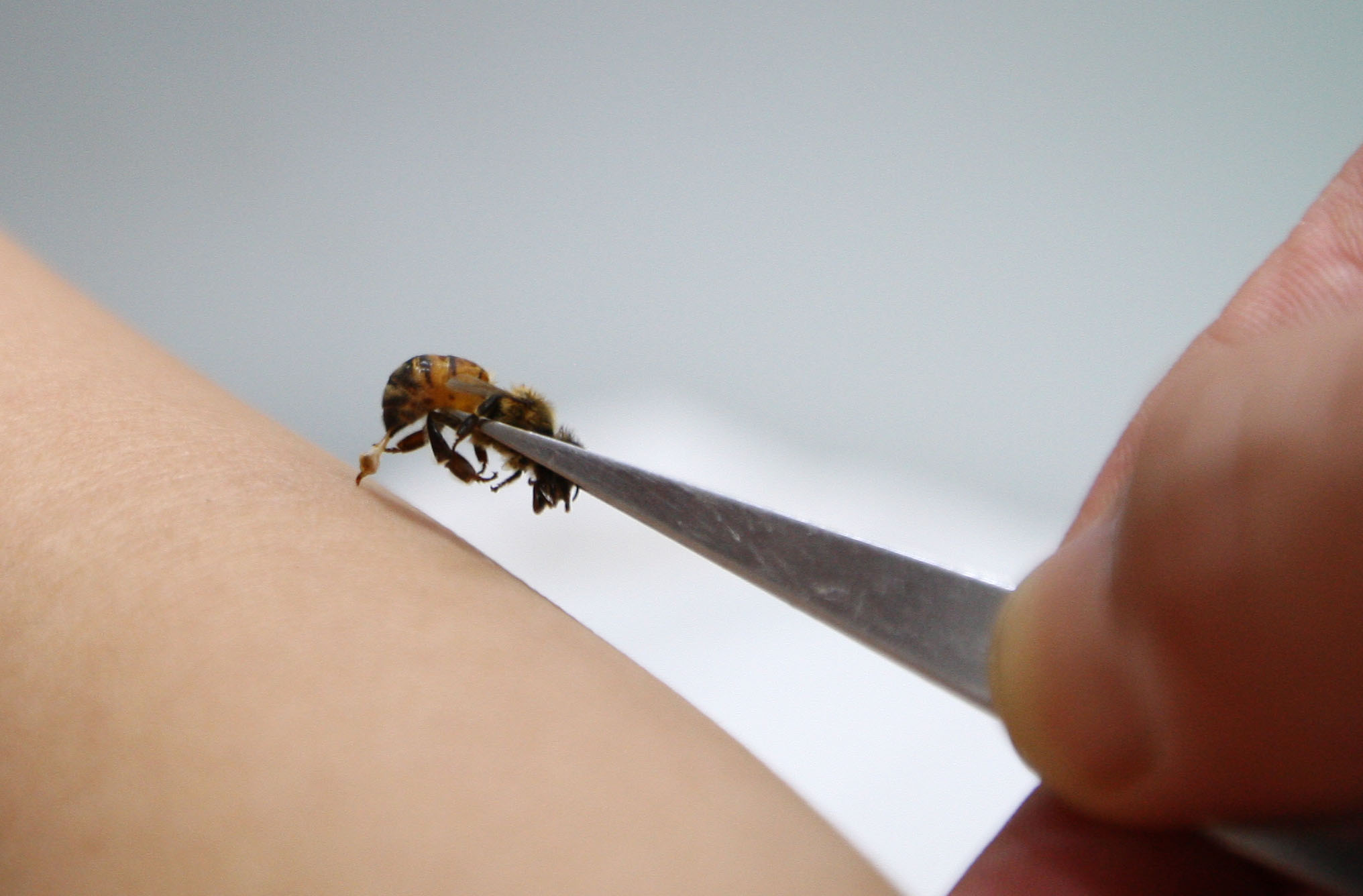 野外毒蜂蜇伤怎么处理,女子被蜂蛰被警察送医