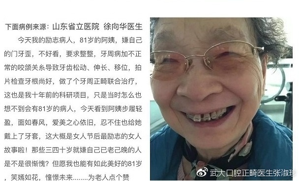 30多岁还可以正畸吗,30多岁还适合做正畸吗