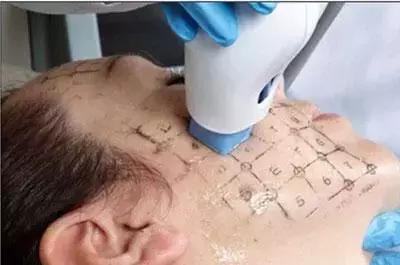 范冰冰用的哪款美容仪,如何看待范冰冰的自创美容仪品牌