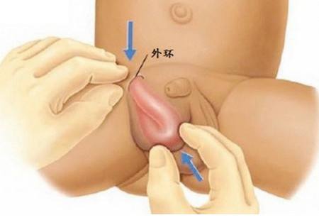 婴儿的护理举措,婴儿的护理主要是哪些方面