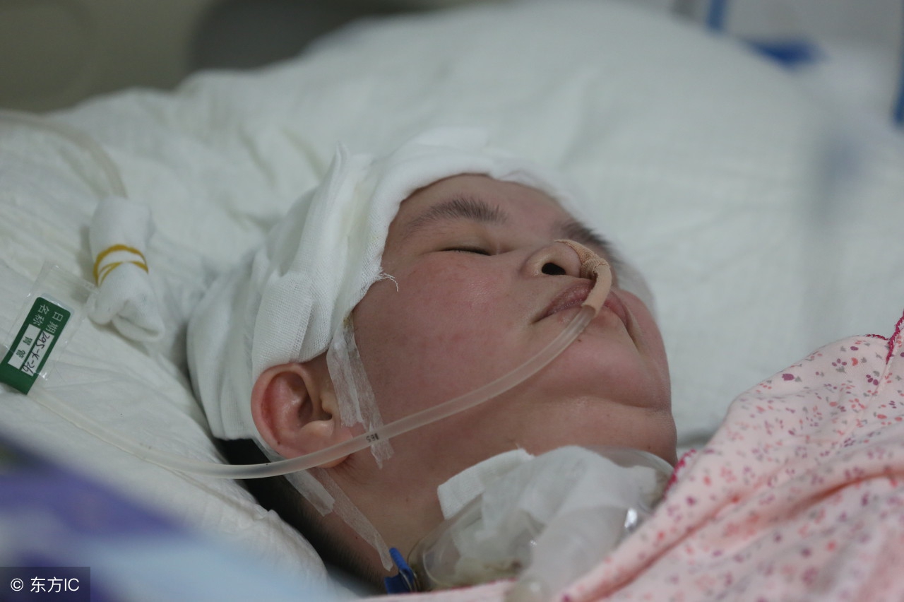 脑溢血后遗症的康复锻炼方法,脑溢血后遗症能不能康复