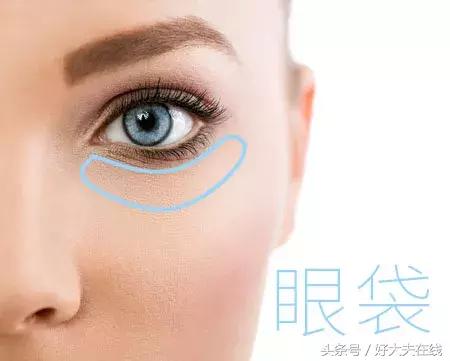 眼袋泪沟怎么去除男生,眼袋和泪沟怎么去除要多少钱